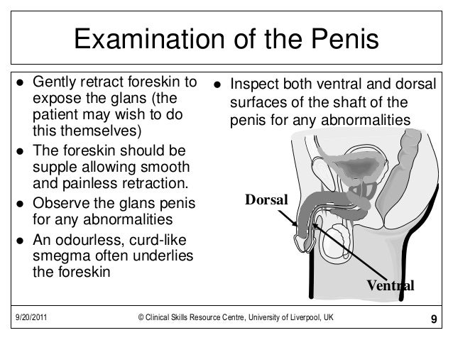 physical examination male including penis exam Altruistic sperm donor